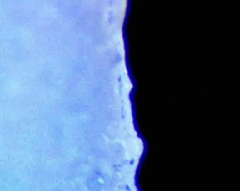 40% Less Macrophage Density