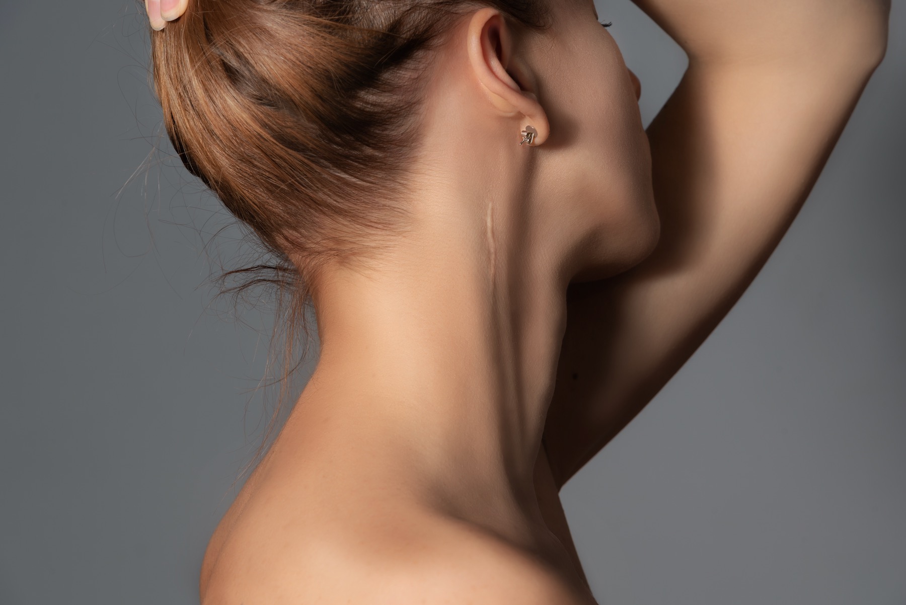 Surgery Scalpel In The News Woman Showing Scar On Neck
